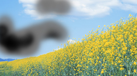 緑内障レーザー治療